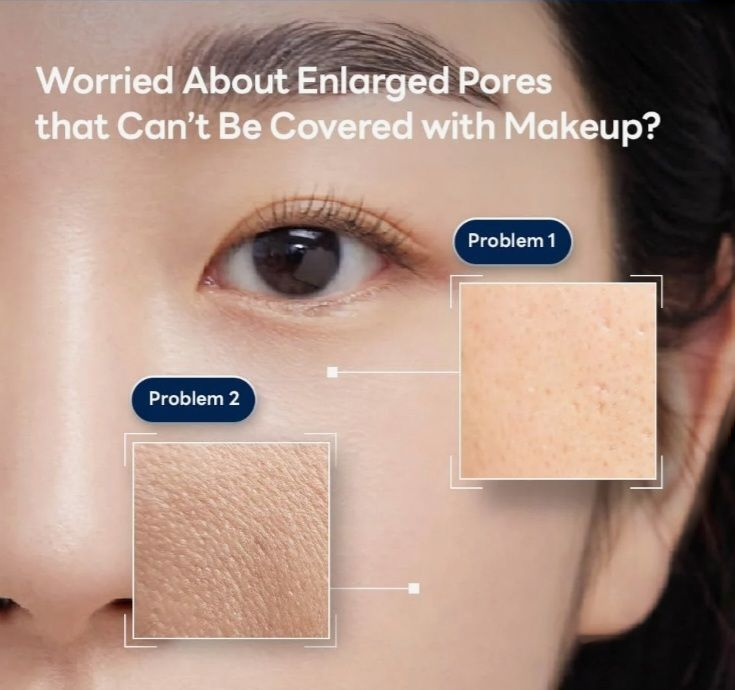 Mediheal Spicule Pore Tightening System 2